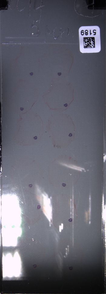 Media type: image; Special Collections 4011   shows specimen_part histological serial section;